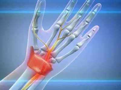 Растяжении связок кисти руки: симптомы, диагностика, лечение в клинике 
