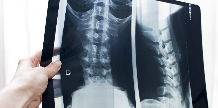 Рентген позвоночника в Саратове по доступной цене