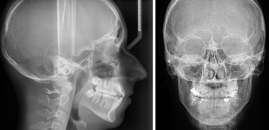 Влияет ли рентген на потенцию у мужчин - Клиника Екатерининская Сочи