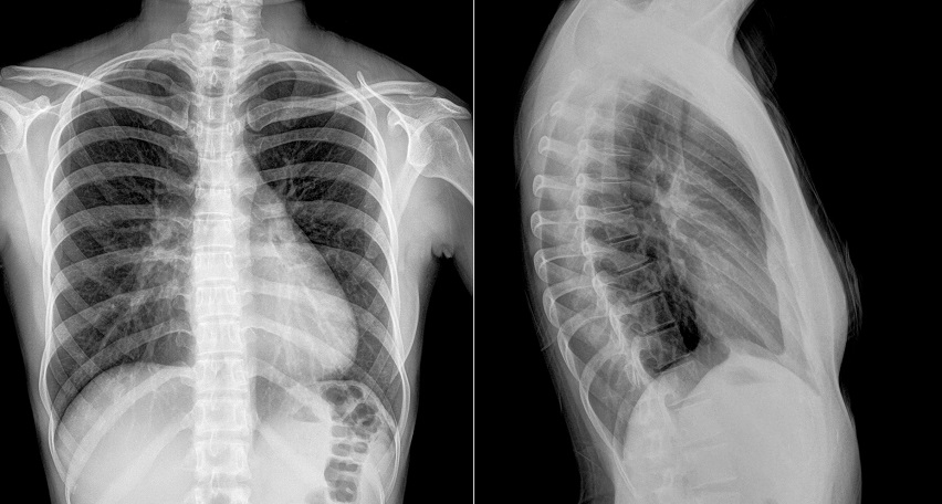 Сделать рентген в Видном | Рентгенография суставов и органов