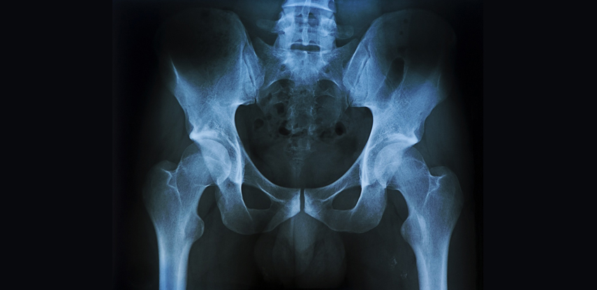 Рентген позвоночника: что показывает снимок и как подготовиться к диагностике?